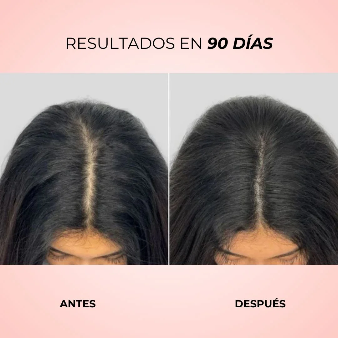 Kiesu - Cepillo LED Estimulador de Crecimiento Capilar