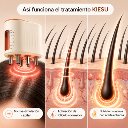 KIESU - Renacer Capilar