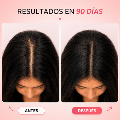Kiesu — Tratamiento LED para Recuperar la Densidad y Frenar la Caída