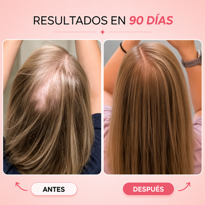 Kiesu — Tratamiento LED para Recuperar la Densidad y Frenar la Caída